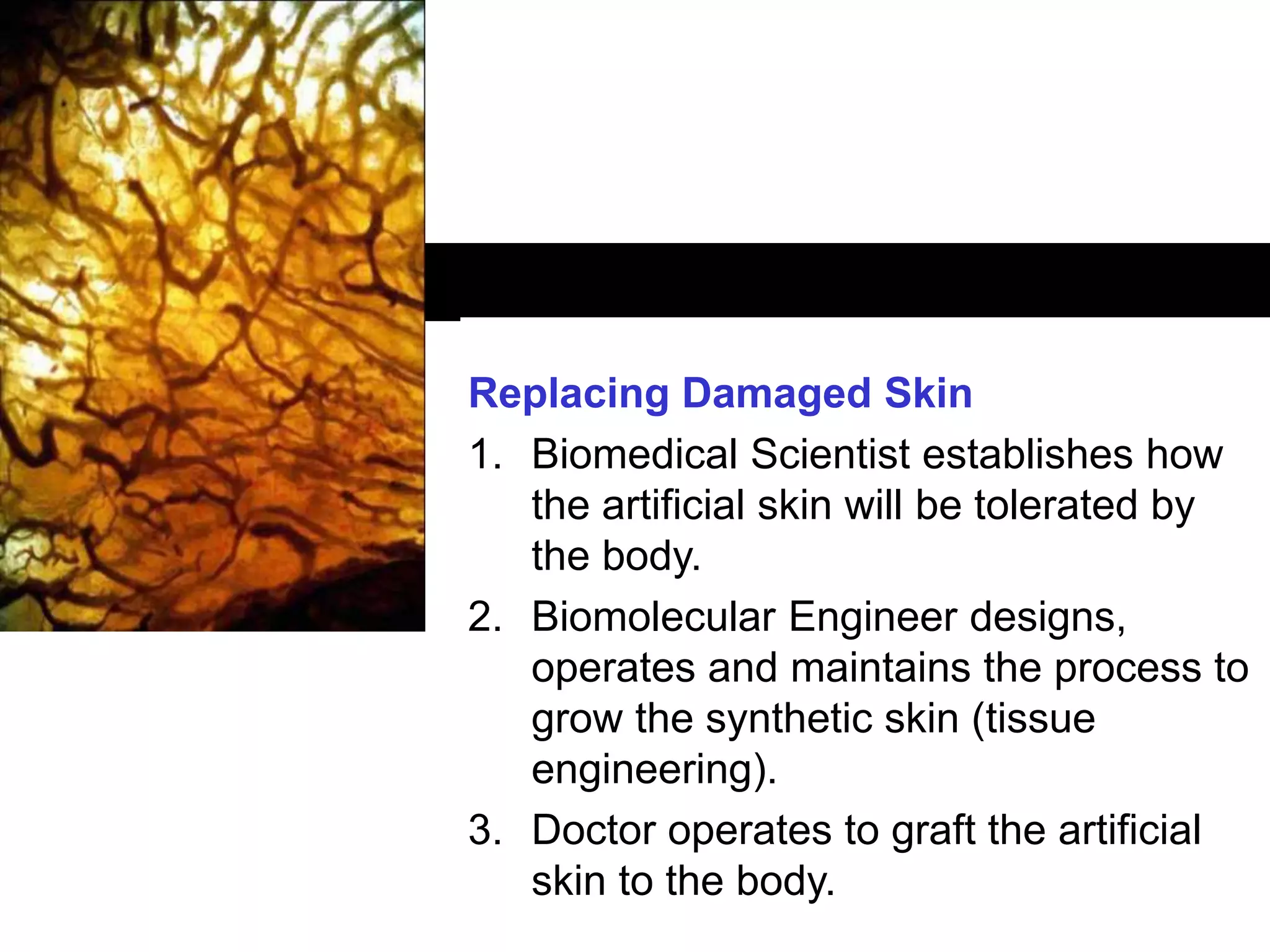 CRICOS: 00116K
Replacing Damaged Skin
1. Biomedical Scientist establishes how
the artificial skin will be tolerated by
the body.
2. Biomolecular Engineer designs,
operates and maintains the process to
grow the synthetic skin (tissue
engineering).
3. Doctor operates to graft the artificial
skin to the body.
 