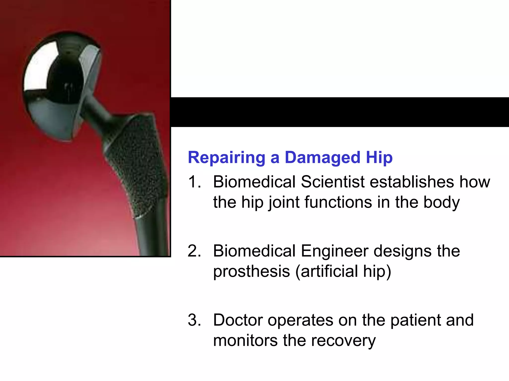 CRICOS: 00116K
Repairing a Damaged Hip
1. Biomedical Scientist establishes how
the hip joint functions in the body
2. Biomedical Engineer designs the
prosthesis (artificial hip)
3. Doctor operates on the patient and
monitors the recovery
 