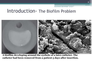 2
                                           Hannah Barber, MicroN BASE   10/15/11




   Introduction- The Biofilm Problem




                                                                                       Image courtesy of MedScape.com
A biofilm developing around the eyehole of a latex catheter. The
catheter had been removed from a patient 5 days after insertion.
 