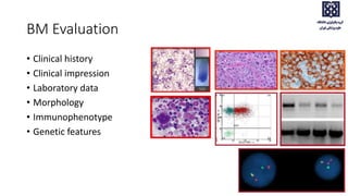 BM Evaluation
• Clinical history
• Clinical impression
• Laboratory data
• Morphology
• Immunophenotype
• Genetic features
 