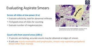 Evaluating Aspirate Smears
Screen all slides at low power (4 x)
• Evaluate cellularity, look for abnormal infiltrate
• Find good areas of slides for counting
• Evaluate number of megakaryocytes
Count cells from several areas (100 x)
• If spicules are lacking, accurate counts may be obtained at edges of smears
• If cells are mainly neutrophils and lymphocytes, smears may represent peripeheral
blood rather than marrow
The preparation can be considered satisfactory only when marrow
particles and free marrow cells can be seen in stained films.
 