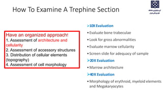 How To Examine A Trephine Section
10X Evaluation
•Evaluate bone trabeculae
•Look for gross abnormalities
•Evaluate marrow cellularity
•Screen slide for adequacy of sample
20X Evaluation
•Marrow architecture
40X Evaluation
•Morphology of erythroid, myeloid elements
and Megakaryocytes
Have an organized approach!
1. Assessment of architecture and
cellularity
2. Assessment of accessory structures
3. Distribution of cellular elements
(topography)
4. Assessment of cell morphology
 