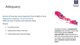 Adequacy:
Quality of marrow more important than length of core
-Adequate sampling: 1.5 cm (1.6-2cm)
-H&E (at least 2 levels) and reticulin stains
•Avoid
 Crushed areas
 Subcortical fatty marrow
 Intertrabecular hemorrhage
This BM core biopsy is suboptimal for
evaluation with cartilage on both ends
of the biopsy flanking minimal
subcortical BM. Subcortical marrow is
often not representative of the marrow
as a whole, and a statement to this
effect should be issued in the final
report.
 