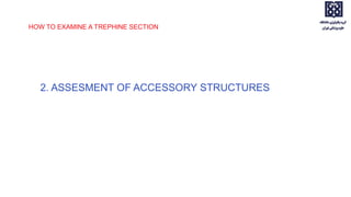 2. ASSESMENT OF ACCESSORY STRUCTURES
HOW TO EXAMINE A TREPHINE SECTION
 