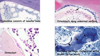 Trabeculae consists of lamellar bone Osteoblasts along endosteal surface
Ossifying cartilage. Osteocytes within
lacuna (arrow head).
Osteoclast
 