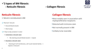 Reticulin fibrosis
 Reticulin is normally present in BM
 ‘Normal’ reticulin
• Around blood vessels
• Short wisps
 • Day-to-day variation in silver
• Underdone reticulin stain
• - No staining around blood vessels -> repeat
• Overdone reticulin stain
• - Staining of cell membranes, cell nuceli stained darkly - >
repeat or discount
•
Collagen fibrosis
Most notably seen in association with
myeloproliferative neoplasms
Detected with trichrome stain
Not normally present in BM
Unlikely to be reversible
2 types of BM fibrosis:
- Reticulin fibrosis - Collagen fibrosis
 