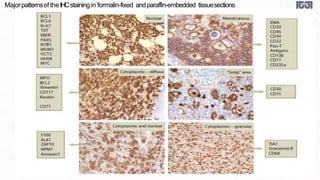 Majorpatternsof theIHCstainingin formalin-fixed andparaffin-embedded tissuesections
 