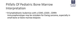 Pitfalls Of Pediatric Bone Marrow
Interpretation
• B-lymphoblastic leukemias with a CD45-,CD20-, CD99+
immunophenotype may be mistaken for Ewing sarcoma, especially in
small bone or bone marrow biopsies
 