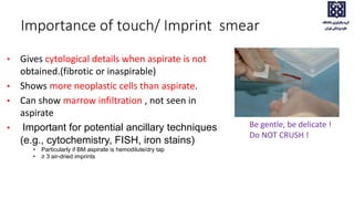 Importance of touch/ Imprint smear
• Gives cytological details when aspirate is not
obtained.(fibrotic or inaspirable)
• Shows more neoplastic cells than aspirate.
• Can show marrow infiltration , not seen in
aspirate
• Important for potential ancillary techniques
(e.g., cytochemistry, FISH, iron stains)
• Particularly if BM aspirate is hemodilute/dry tap
• ≥ 3 air-dried imprints
Be gentle, be delicate !
Do NOT CRUSH !
 