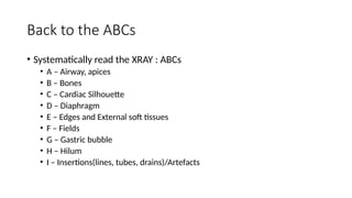 Chest Xray reading 101 or Chest Radiography | PPTX