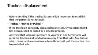 Displaced Trache Algorithm Chest Xray reading 101 or Chest Radiography | PPTX