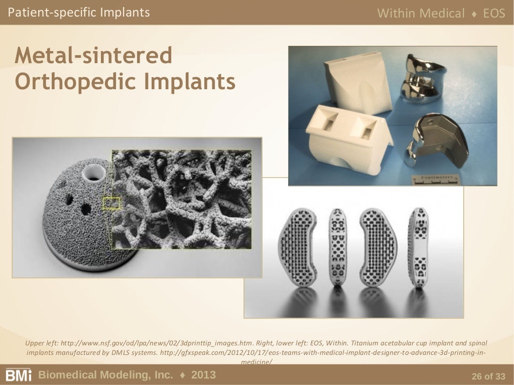 Anatomical Engineering for the Intelligent Design of Medical Devices