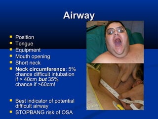 AirwayAirway
 PositionPosition
 TongueTongue
 EquipmentEquipment
 Mouth openingMouth opening
 Short neckShort neck
 Neck circumferenceNeck circumference: 5%: 5%
chance difficult intubationchance difficult intubation
if > 40cmif > 40cm butbut 35%35%
chance if >60cm!chance if >60cm!
 Best indicator of potentialBest indicator of potential
difficult airwaydifficult airway
 STOPBANG risk of OSASTOPBANG risk of OSA
 