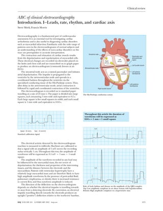 ABC of clinical electrocardiography
Introduction. I—Leads, rate, rhythm, and cardiac axis
Steve Meek, Francis Morris
Electrocardiography is a fundamental part of cardiovascular
assessment. It is an essential tool for investigating cardiac
arrhythmias and is also useful in diagnosing cardiac disorders
such as myocardial infarction. Familiarity with the wide range of
patterns seen in the electrocardiograms of normal subjects and
an understanding of the effects of non-cardiac disorders on the
trace are prerequisites to accurate interpretation.
The contraction and relaxation of cardiac muscle results
from the depolarisation and repolarisation of myocardial cells.
These electrical changes are recorded via electrodes placed on
the limbs and chest wall and are transcribed on to graph paper
to produce an electrocardiogram (commonly known as an
ECG).
The sinoatrial node acts as a natural pacemaker and initiates
atrial depolarisation. The impulse is propagated to the
ventricles by the atrioventricular node and spreads in a
coordinated fashion throughout the ventricles via the
specialised conducting tissue of the His-Purkinje system. Thus,
after delay in the atrioventricular mode, atrial contraction is
followed by rapid and coordinated contraction of the ventricles.
The electrocardiogram is recorded on to standard paper
travelling at a rate of 25 mm/s. The paper is divided into large
squares, each measuring 5 mm wide and equivalent to 0.2 s.
Each large square is five small squares in width, and each small
square is 1 mm wide and equivalent to 0.04 s.
The electrical activity detected by the electrocardiogram
machine is measured in millivolts. Machines are calibrated so
that a signal with an amplitude of 1 mV moves the recording
stylus vertically 1 cm. Throughout this text, the amplitude of
waveforms will be expressed as: 0.1 mV = 1 mm = 1 small
square.
The amplitude of the waveform recorded in any lead may
be influenced by the myocardial mass, the net vector of
depolarisation, the thickness and properties of the intervening
tissues, and the distance between the electrode and the
myocardium. Patients with ventricular hypertrophy have a
relatively large myocardial mass and are therefore likely to have
high amplitude waveforms. In the presence of pericardial fluid,
pulmonary emphysema, or obesity, there is increased resistance
to current flow, and thus waveform amplitude is reduced.
The direction of the deflection on the electrocardiogram
depends on whether the electrical impulse is travelling towards
or away from a detecting electrode. By convention, an electrical
impulse travelling directly towards the electrode produces an
upright (“positive”) deflection relative to the isoelectric baseline,
Throughout this article the duration of
waveforms will be expressed as
0.04 s = 1 mm = 1 small square
Sinoatrial node
Electrically inert
atrioventricular
region
Left bundle branch
Left anterior
hemifascicle
Left posterior
hemifascicle
Right
atrium
Left
atrium
Right
ventricle
Left
ventricle
Atrioventricular node
Right bundle branch
The His-Purkinje conduction system
V5
V5
Role of body habitus and disease on the amplitude of the QRS complex.
Top: Low amplitude complexes in an obese woman with hypothyroidism.
Bottom: High amplitude complexes in a hypertensive man
Speed : 25 mm/s Gain : 10 mm/mV
Standard calibration signal
Clinical review
415BMJ VOLUME 324 16 FEBRUARY 2002 bmj.com
 