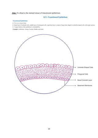 20
Aim: To observe the stained smear of transitional epithelium
 