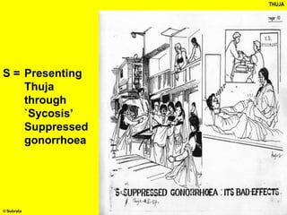 THUJA
S = Presenting
Thuja
through
`Sycosis’
Suppressed
gonorrhoea
© Subrata
 