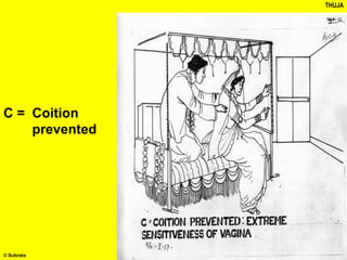 THUJA
C = Coition
prevented
© Subrata
 