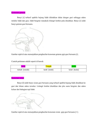 Konsonan getaran

       Bunyi [r] terhasil apabila hujung lidah diletakkan dekat dengan gusi sehingga udara
melalui lidah dan gusi, lidah bergetar manakala lelangit lembut pula dinaikkan. Bunyi [r] ialah
bunyi getaran gusi bersuara.




Gambar rajah di atas menunjukkan penghasilan konsonan getaran gigi-gusi bersuara [r].


Contoh perkataan adalah seperti di bawah.

             Awal                           Tengah                            Akhir
       rumah [rumah]                     tarah [tarah]                     ketar [ketar]



Konsonan sisian

       Bunyi [l] ialah bunyi sisian gusi bersuara yang terhasil apabila hujung lidah dinaikkan ke
gusi dan laluan udara tersekat. Lelangit lembut dinaikkan dan pita suara bergetar dan udara
keluar dari bahagian tepi lidah.




Gambar rajah di atas menunjukkan penghasilan konsonan sisian gigi-gusi bersuara [ l ].
 