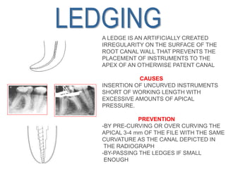 Ledge Radiograph BMP.ppt