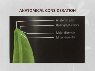 ANATOMICAL CONSIDERATION
 