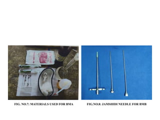 FIG. NO.7: MATERIALS USED FOR BMA FIG.NO.8: JAMSHIDI NEEDLE FOR BMB
 