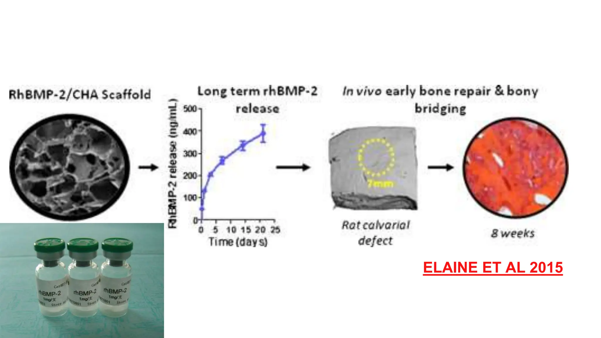 bone morphogenetic protein in periodontics | PPTX
