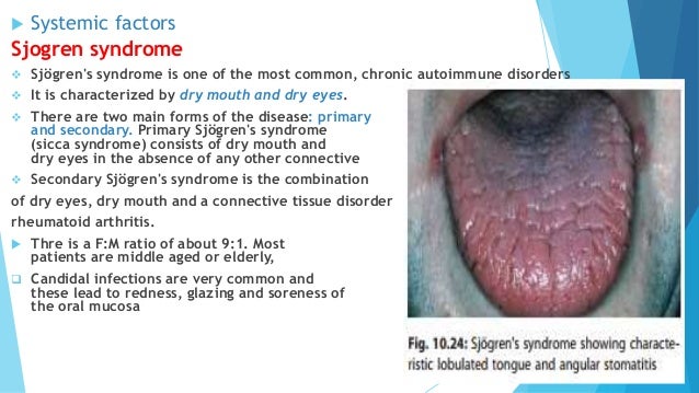 Oral Medicine Burning Mouth Syndrome