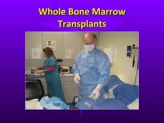 Whole Bone Marrow Transplants 