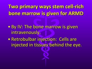 Two primary ways stem cell-rich bone marrow is given for ARMD By IV: The bone marrow is given intravenously. Retrobulbar injection:  Cells are injected in tissues behind the eye.  