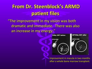 From Dr. Steenblock ’s ARMD patient files  “ The improvement in my vision was both dramatic and immediate.  There was also an increase in my energy.” Improvement in macula in two months after a whole bone marrow transplant. 