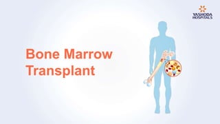 Bone Marrow
Transplant
 