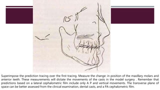 Superimpose the prediction tracing over the first tracing. Measure the change: in position of the maxillary molars and
anterior teeth. These measurements will dictate the movements of the casts in the model surgery . Remember that
predictions based on a lateral cephalometric film include only A P and vertical movements. The transverse plane of
space can be better assessed from the clinical examination, dental casts, and a PA cephalometric film.
 