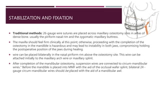 STABILIZATION AND FIXATION
 Traditional methods: 26-gauge wire sutures are placed across maxillary osteotomy sites in areas of
dense bone. usually the piriform nasal rim and the zygomatic-maxillary buttress.
 The maxilla should feel firm clinically al this point; otherwise, proceeding with the completion of the
osteotomy in the mandible is hazardous and may lead to instability in both jaws, compromising holding
the postoperative position of the jaws during healing.
 wire can be placed bilaterally in the nasal piriform rim above the osteotomy site. This wire can be
attached initially to the maxillary arch wire or maxillary splint.
 After completion of the mandibular osteotomy, suspension wires are connected to circum-mandibular
wires." Before the mandible is placed into MMF with the aid of the occlusal wafer splint, bilateral 24 -
gauge circum-mandibular wires should be placed with the aid of a mandibular awl.
 