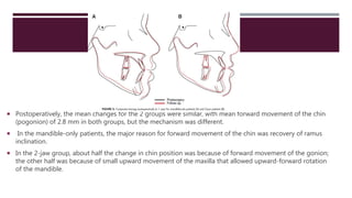  Postoperatively, the mean changes for the 2 groups were similar, with mean forward movement of the chin
(pogonion) of 2.8 mm in both groups, but the mechanism was different.
 In the mandible-only patients, the major reason for forward movement of the chin was recovery of ramus
inclination.
 In the 2-jaw group, about half the change in chin position was because of forward movement of the gonion;
the other half was because of small upward movement of the maxilla that allowed upward-forward rotation
of the mandible.
 