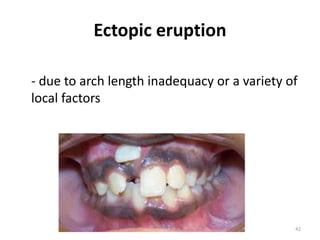 Tooth eruption and shedding - complete package | PPTX