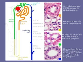 TB trụ thấp, B/tg ưa eozin,
Có bờ bàn chải rộng, dài,
Đk gấp 2 ống lượn xa.
Biểu mô dẹt, đk bằng ½ ống
lượn xa, không bờ bàn chải.
Đk bằng ½ ống lượn gần, biểu
mô trụ thấp, khó thấy bở
bàn chải (do quá ngắn, ít).
Đk thường lớn hơn ống lượn
Gần.TB hình lập phương
hoặc trụ, giới hạn TB rõ, bào
tương bắt màu yếu hoặc
không nhuộm màu.
 