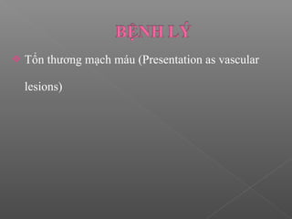  Tổn thương mạch máu (Presentation as vascular
lesions)
 