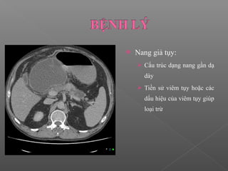  Nang giả tụy:
 Cấu trúc dạng nang gần dạ
dày
 Tiền sử viêm tụy hoặc các
dấu hiệu của viêm tụy giúp
loại trừ
 