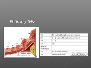  Phân lo i TNMạ
 