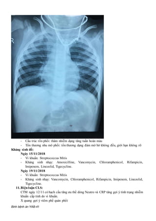Bình bệnh án YAB-41
- Cấu trúc rốn phổi: thâm nhiễm dạng tăng tuần hoàn máu
- Tổn thương nhu mô phổi: tổn thương dạng đám mờ bờ không đều, giới hạn không rõ
Kháng sinh đồ:
Ngày 15/11/2018
- Vi khuẩn: Streptococcus Mitis
- Kháng sinh nhạy: Amoxicilline, Vancomycin, Chloramphenicol, Rifampicin,
Imipenem, Linezolid, Tigecycline.
Ngày 19/11/2018
- Vi khuẩn: Streptococcus Mitis
- Kháng sinh nhạy: Vancomycin, Chloramphenicol, Rifampicin, Imipenem, Linezolid,
Tigecycline.
11.Biệnluận CLS:
CTM ngày 12/11 có bạch cầu tăng ưu thế dòng Neutro và CRP tăng gợi ý tình trạng nhiễm
khuẩn cấp tính do vi khuẩn.
X quang gợi ý viêm phế quản phổi
 
