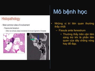Mô bệnh học
• Những vị trí liên quan thường
thấy nhất
– Fissula ante fenestrum
• Thường thấy trên cận lâm
sàng trừ khi là phần liên
quan của dây chằng vòng
hay đế đạp.
 