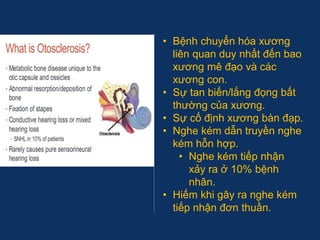 • Bệnh chuyển hóa xương
liên quan duy nhất đến bao
xương mê đạo và các
xương con.
• Sự tan biến/lắng đọng bất
thường của xương.
• Sự cố định xương bàn đạp.
• Nghe kém dẫn truyền nghe
kém hỗn hợp.
• Nghe kém tiếp nhận
xảy ra ở 10% bệnh
nhân.
• Hiếm khi gây ra nghe kém
tiếp nhận đơn thuần.
 