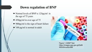Down regulation of BNP
 Normal levels of BNP is 125pg/ml in
the age of 75 years
 450pg/ml in over age of 75
 900pg/ml is the sign of heart failure
 100 pg/ml is normal in adult
Figure 1.3:BNP Test
https://images.app.goo.gl/Zs89
KM3r9muaQo3B8
 