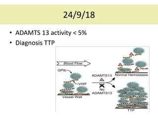 How I diagnose and manage HUS & TTP - Marie Scully & Jim Down | PPTX