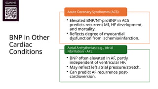 BNP in Heart failure (Final Version).pptx