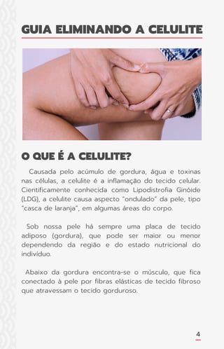 GUIA ELIMINANDO A CELULITE
O QUE É A CELULITE?
Causada pelo acúmulo de gordura, água e toxinas
nas células, a celulite é a inflamação do tecido celular.
Cientificamente conhecida como Lipodistrofia Ginóide
(LDG), a celulite causa aspecto “ondulado” da pele, tipo
“casca de laranja”, em algumas áreas do corpo.
Sob nossa pele há sempre uma placa de tecido
adiposo (gordura), que pode ser maior ou menor
dependendo da região e do estado nutricional do
indivíduo.
Abaixo da gordura encontra-se o músculo, que fica
conectado à pele por fibras elásticas de tecido fibroso
que atravessam o tecido gorduroso.
4
 