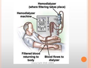 Hiç işlev yapmayan hastalara ise böbrek nakli yapılır. Böbrek nakli, hasta böbreğin organlarını bağışlayan insanlardan alınan sağlam bir böbrekle değiştirilmesidir. Böbrek naklinden sonra da genellikle uzun bir ilaç tedavisi başlar.