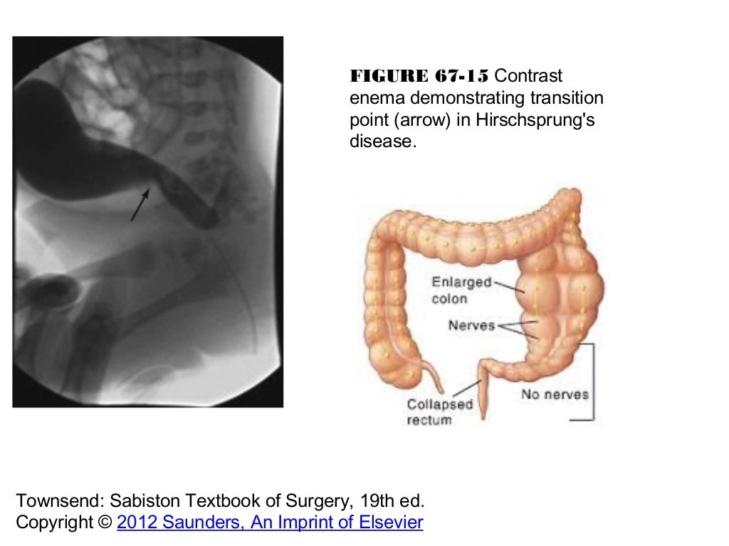 Board review abdomen 9.4.13