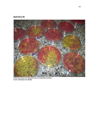 42 
Apêndice 04 
Colônias típicas de Staphylococuus coagulase positiva 
Fonte: Marcela Ines Muller 
 