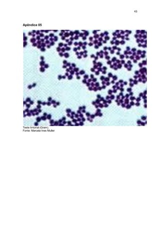 43 
Apêndice 05 
Teste tintorial (Gram). 
Fonte: Marcela Ines Muller 
 